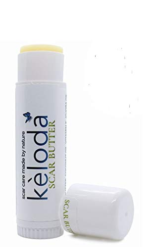 KELODA Keloid Scar Care Butter Stick | Scars and Keloids Removal Balm | For Surgical Scars and Keloids from Piercings, Stretch Marks, Acne | With Anti Scar Cocoa, Shea Butter, Coconut and Jojoba Oils