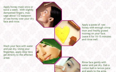 How to Treat Acne Naturally