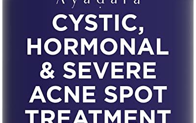 Ayadara Cystic Acne Spot Treatment, Overnight Hormonal Cystic Acne Treatment for Face, Women, Men and Teens, Cystic Hormonal Acne Treatment for Body, Pimple Cream, Sulfur Acne Spot Treatment, 120 Uses