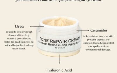 How To Get Rid Of Hyperpigmentation