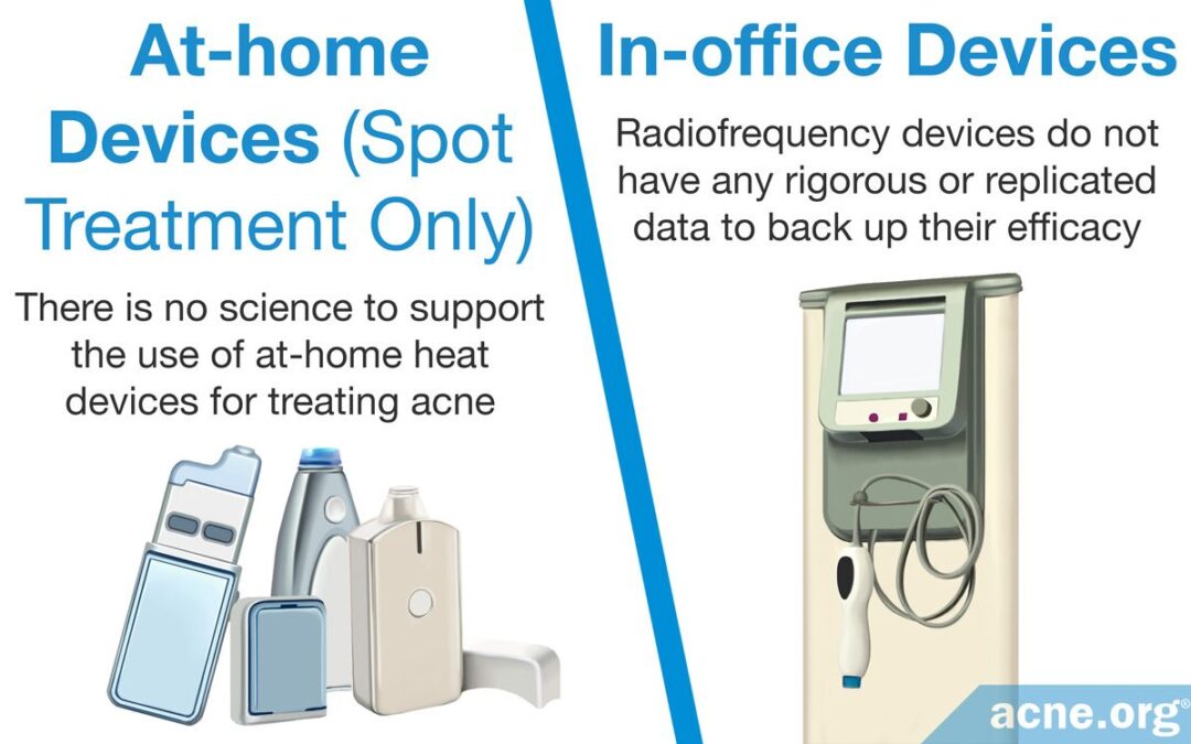 heat-therapy-for-acne