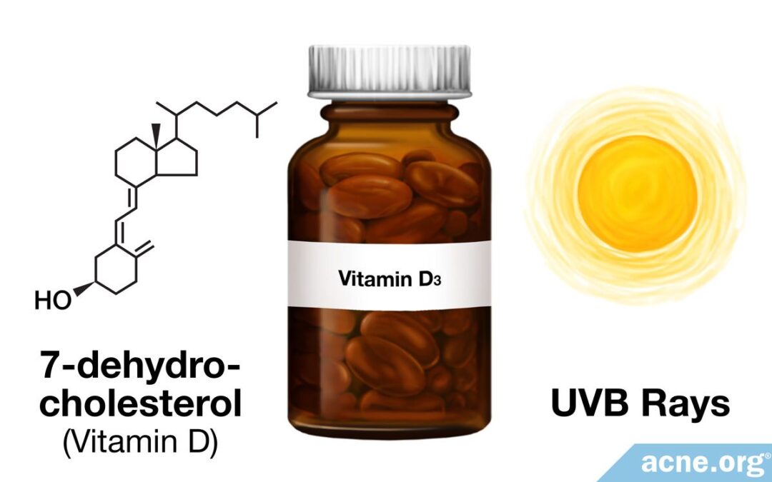 does-vitamin-d-help-treat-acne?