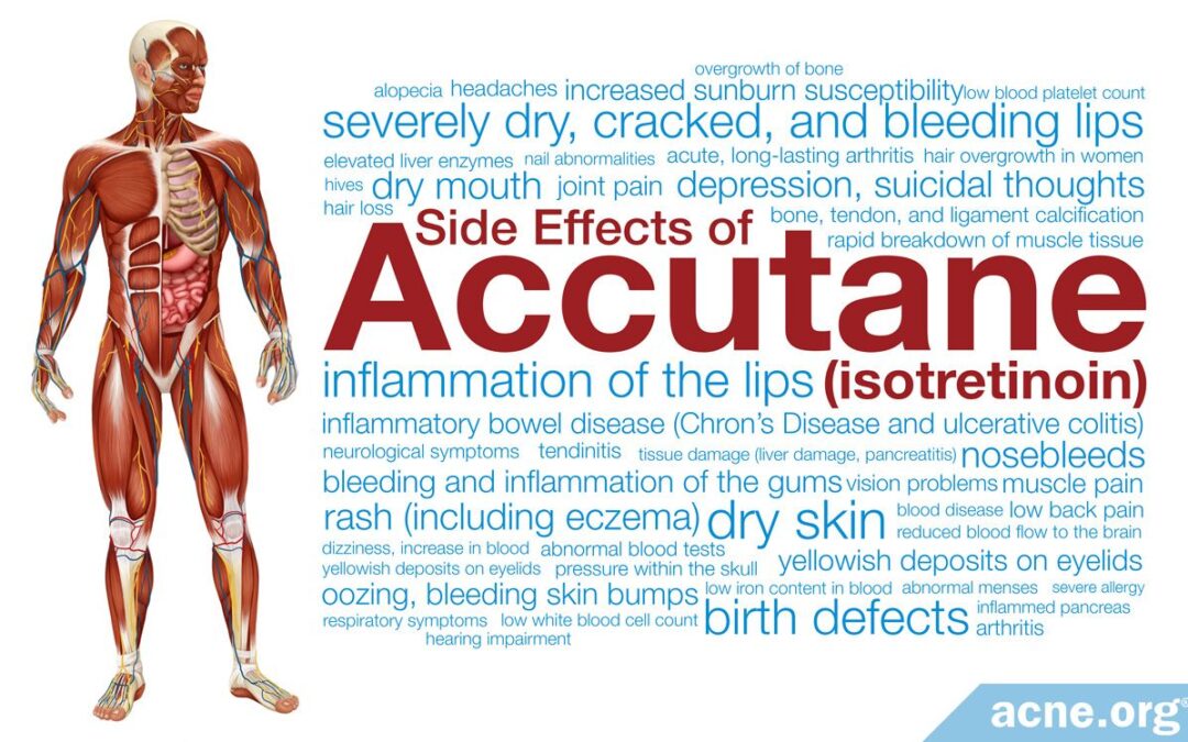 what-are-the-side-effects-of-accutane-(isotretinoin)?