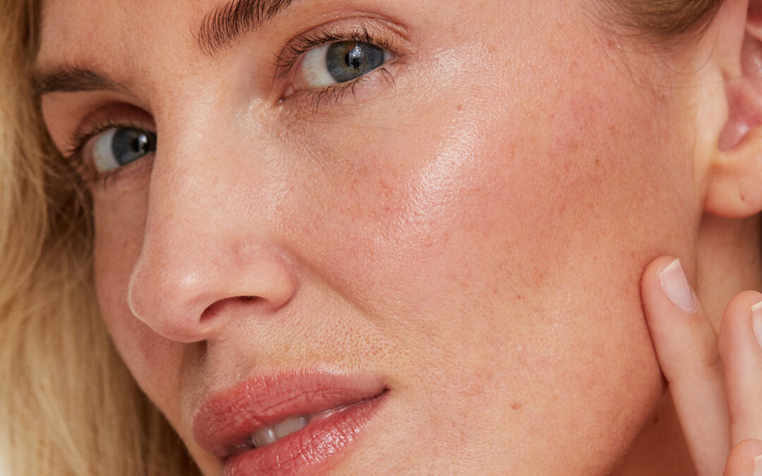 my-skincare-routine-for-redness-prone-and-rosacea-skin