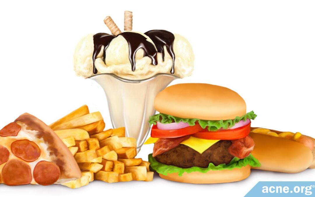 how-fatty-foods-affect-acne