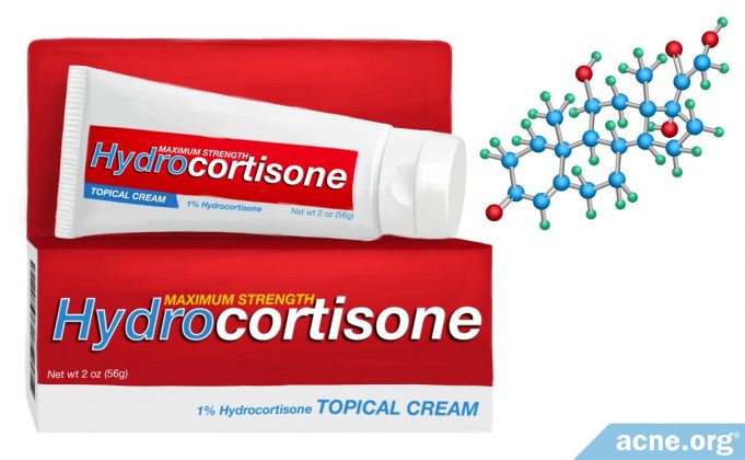 can-topical-hydrocortisone-help-with-acne?