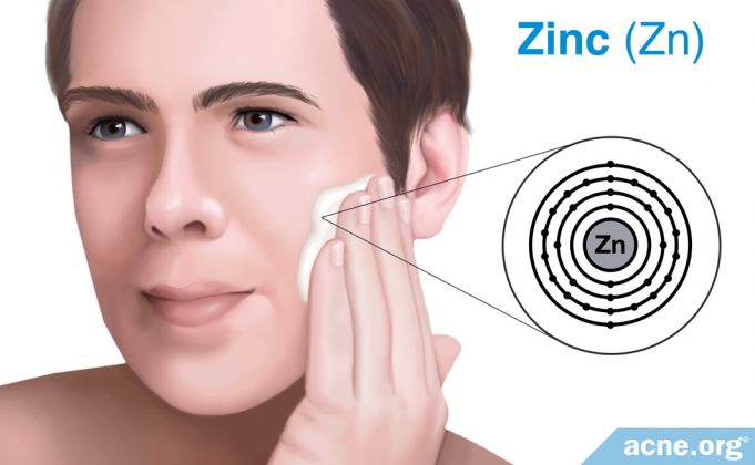 can-topical-zinc-improve-acne?