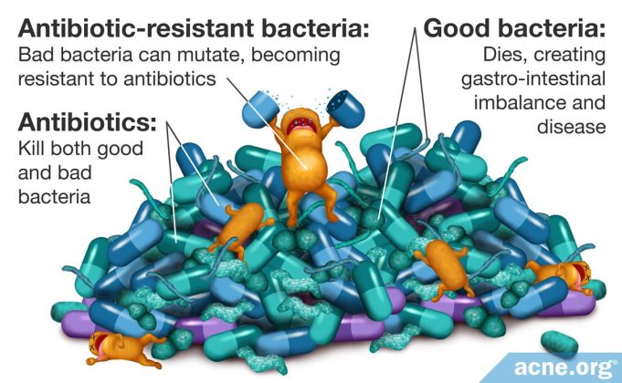 the-dangers-and-ineffectiveness-of-antibiotics-for-acne