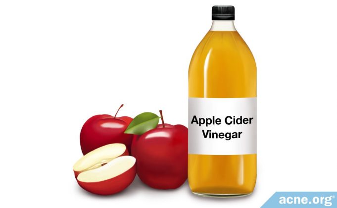 topical-apple-cider-vinegar-and-acne