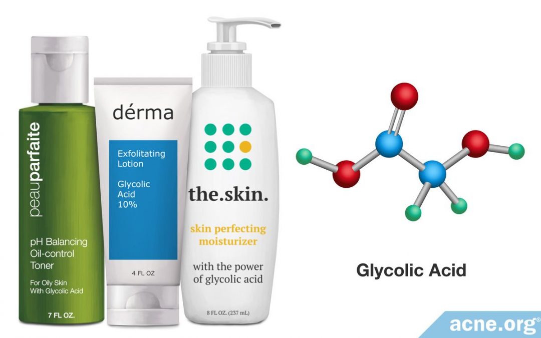 how-glycolic-acid-helps-with-acne