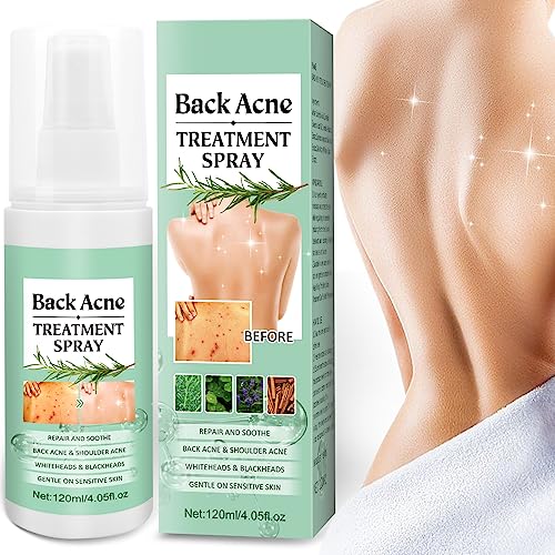 Back Acne Treatment Spray – Back Acne Spray Acne Treatment with Herbal Formula, 2% Salicylic Acid & Tea Tree Oil Body Acne Spray, Body Back Acne Solution, 120ml