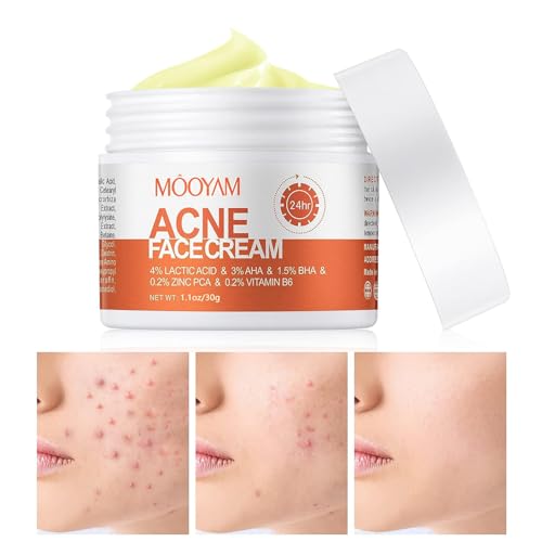 Acne Cream, Acne Spot Treatment for Face and Body, Pimple Cream Spot Treatment, Salicylic Acid Cystic Acne Treatment for Face, Back Acne & Butt Acne Clearing Cream for Teens & Adults