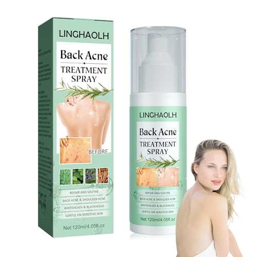 Back Acne Treatment Body Spray,Moisturising Body Acne Cleanser Spray for Women & Men