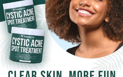 TreeActiv Cystic Acne Spot Treatment: My Honest Results