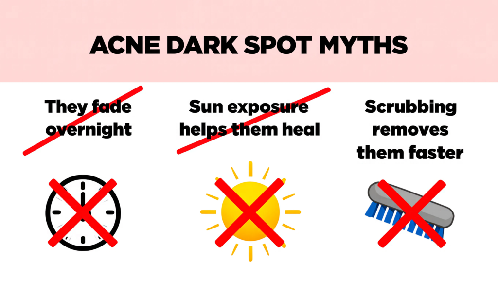 Dark Marks After Acne